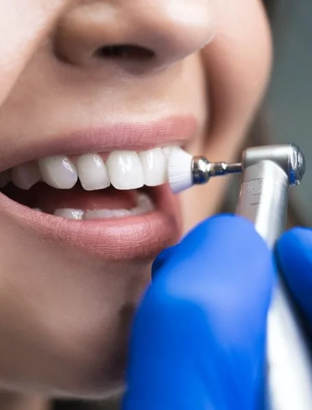 Professional preventive dental care visit