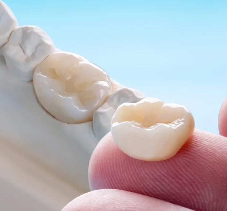 Dental restoration prepared for smile enhancement