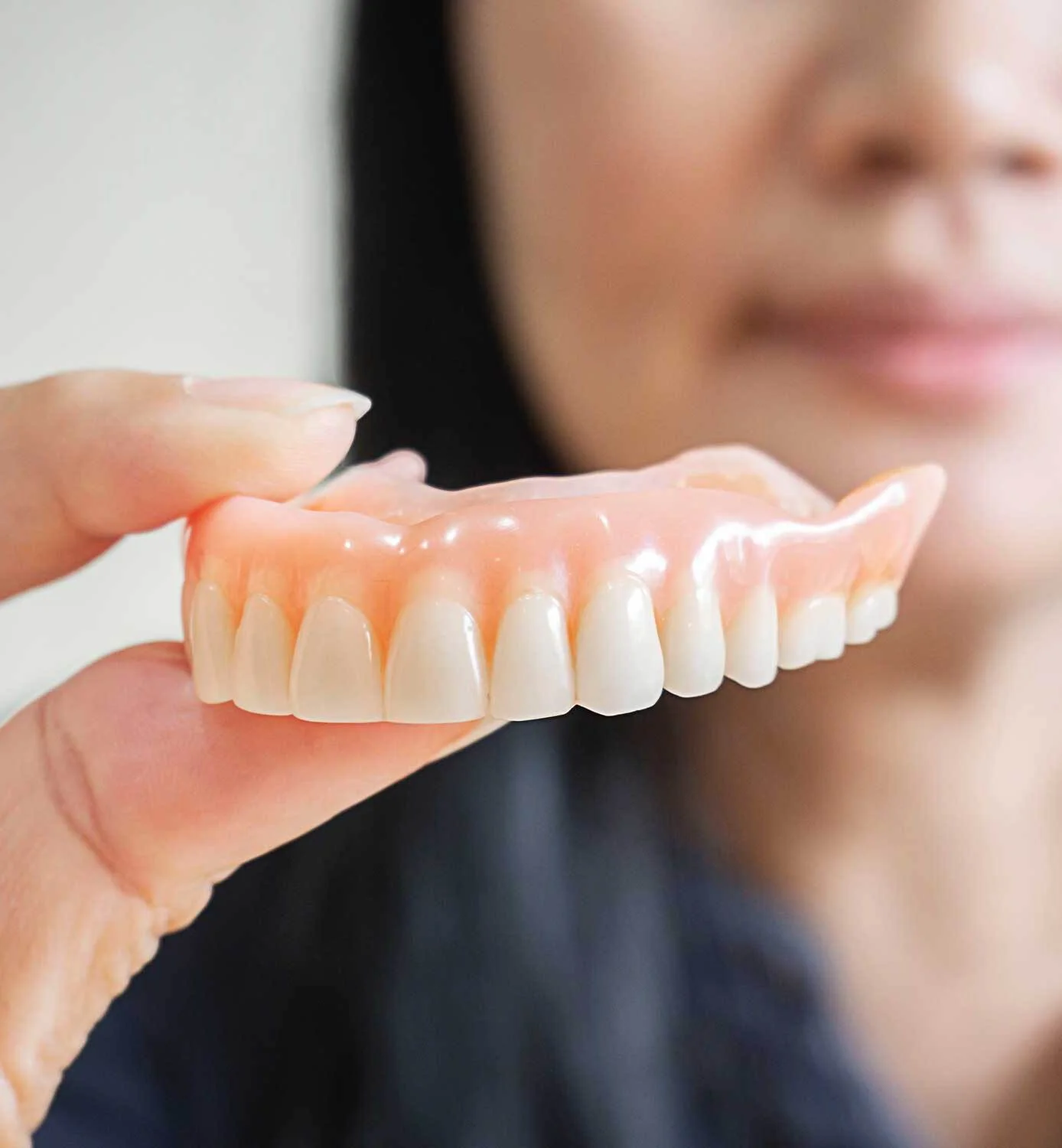 Denture restoration model